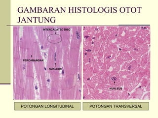 GAMBARAN HISTOLOGIS OTOT
JANTUNG
           INTERCALATED DISC




 PERCABANGAN


               NUKLEUS




                                      NUKLEUS




POTONGAN LONGITUDINAL          POTONGAN TRANSVERSAL
 