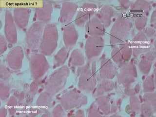 Otot apakah ini ?
                        Inti dipinggir




                                         Penampang
                                         sama besar




Otot skelet penampang
      transversal
 