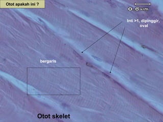 Otot apakah ini ?



                               Inti >1, dipinggir,
                                       oval




                    bergaris




                Otot skelet
 