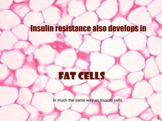 Insulin resistance also develops in




        fat cells

      In much the same way as muscle cells.



                                              68
 