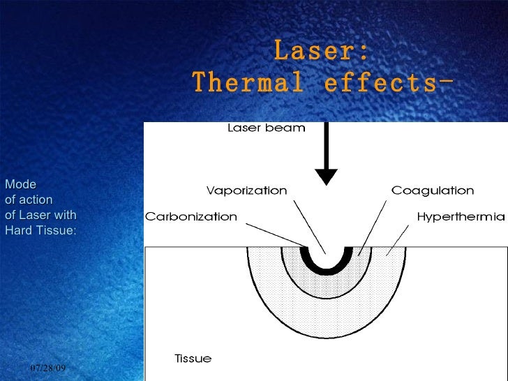 Laser on Hard Tissue