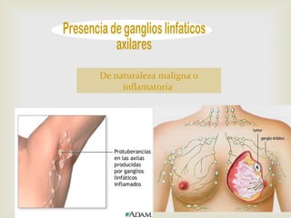 De naturaleza maligna o 
inflamatoria 
 