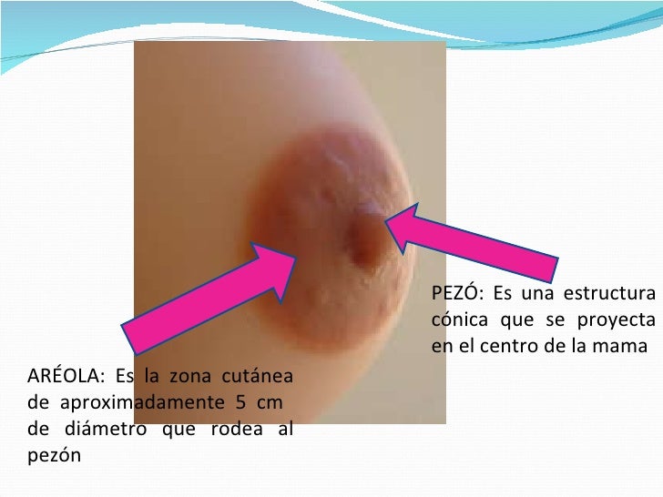 El matiz de la piel a rojo con las pecas