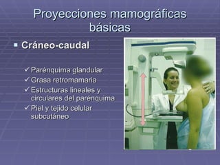 Proyecciones mamográficas básicas Cráneo-caudal Parénquima glandular Grasa retromamaria Estructuras lineales y circulares del parénquima Piel y tejido celular subcutáneo 