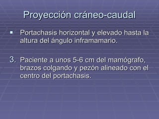 Proyección cráneo-caudal Portachasis horizontal y elevado hasta la altura del ángulo inframamario. Paciente a unos 5-6 cm del mamógrafo, brazos colgando y pezón alineado con el centro del portachasis. 