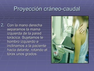 Proyección cráneo-caudal Con la mano derecha separamos la mama izquierda de la pared torácica. Sujetamos le hombro izquierdo e inclinamos a la paciente hacia delante, rotando el tórax unos grados. 