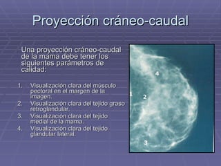 Proyección cráneo-caudal Una proyección cráneo-caudal de la mama debe tener los siguientes parámetros de calidad: Visualización clara del músculo pectoral en el margen de la imagen. Visualización clara del tejido graso retroglandular. Visualización clara del tejido medial de la mama. Visualización clara del tejido glandular lateral. 