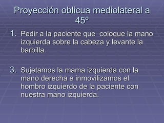 Proyección oblicua mediolateral a 45º Pedir a la paciente que  coloque la mano izquierda sobre la cabeza y levante la barbilla. Sujetamos la mama izquierda con la mano derecha e inmovilizamos el hombro izquierdo de la paciente con nuestra mano izquierda. 