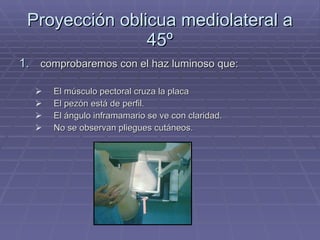 Proyección oblicua mediolateral a 45º comprobaremos con el haz luminoso que: El músculo pectoral cruza la placa El pezón está de perfil. El ángulo inframamario se ve con claridad. No se observan pliegues cutáneos. 