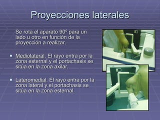 Proyecciones laterales Se rota el aparato 90º para un lado u otro en función de la proyección a realizar. Mediolateral . El rayo entra por la zona esternal y el portachasis se sitúa en la zona axilar. Lateromedial . El rayo entra por la zona lateral y el portachasis se sitúa en la zona esternal. 