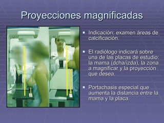 Proyecciones magnificadas Indicación: examen áreas de calcificación. El radiólogo indicará sobre una de las placas de estudio: la mama (dcha/izda), la zona a magnificar y la proyección que desea. Portachasis especial que aumenta la distancia entre la mama y la placa. 