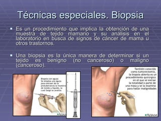 Técnicas especiales. Biopsia Es un procedimiento que implica la obtención de una muestra de tejido mamario y su análisis en el laboratorio en busca de signos de  cáncer de mama  u otros trastornos.   Una biopsia es la única manera de determinar si un tejido es benigno (no canceroso) o maligno (canceroso).   