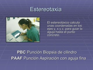Estereotaxia El estereotáxico calcula unas coordenadas en los ejes y, x y z, para guiar la aguja hasta el punto concreto. PBC  Punción Biopsia de cilindro PAAF  Punción Aspiración con aguja fina 