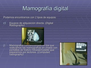 Mamografía digital Podemos encontrarnos con 2 tipos de equipos: Equipos de adquisición directa. (Digital Radiography) Mamógrafos convencionales en los que realizamos las mamografías en chasis con pantallas de fósforo fotoestimulable que pasaremos por lectores. (Computed radiography) 