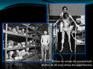 Vítimas no campo de concentração Mulher de 30 anos vítima dos experimentos