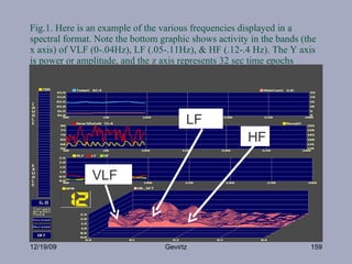 Fig.1. Here is an example of the various frequencies displayed in a spectral format. Note the bottom graphic shows activit...