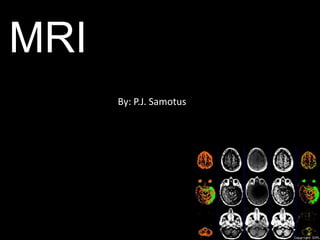 MRI By: P.J. Samotus 