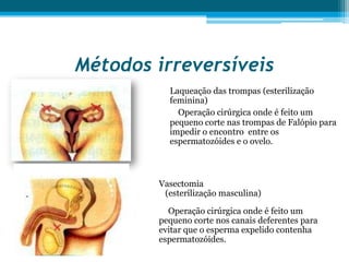 Métodos irreversíveis Laqueação das trompas (esterilização feminina)Operação cirúrgica onde é feito um pequeno corte nas trompas de Falópio para impedir o encontro  entre os espermatozóides e o ovelo.Vasectomia    (esterilização masculina)Operação cirúrgica onde é feito um pequeno corte nos canais deferentes para evitar que o esperma expelido contenha espermatozóides.