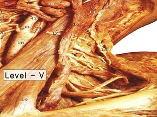C:Neck Dissection | PPT