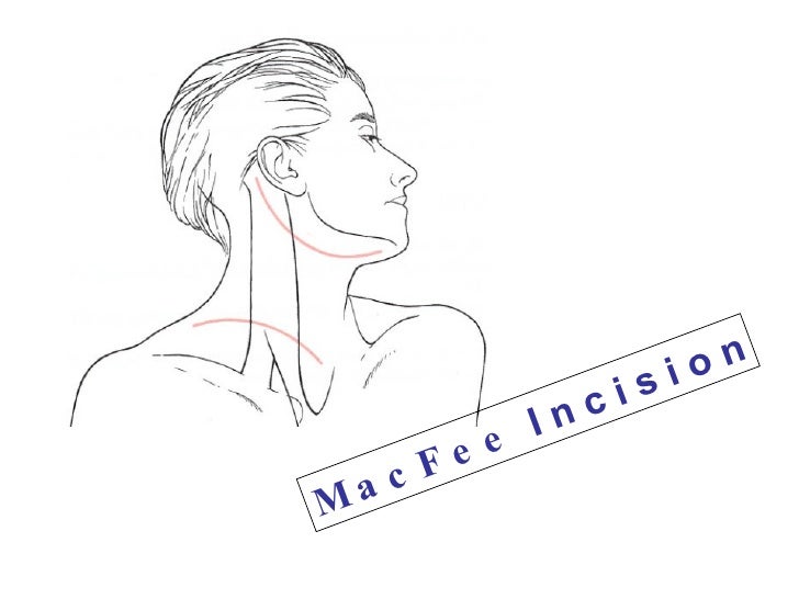 neck diagrams pro crack neck diagrams pro crack