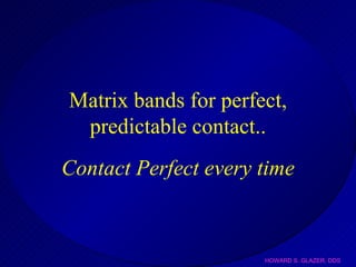 Matrix bands for perfect, predictable contact.. Contact Perfect every time 