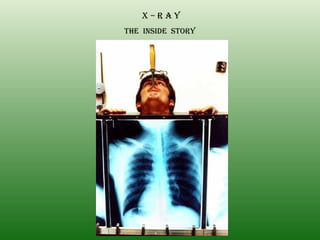 X – R A Y THE  INSIDE  STORY 