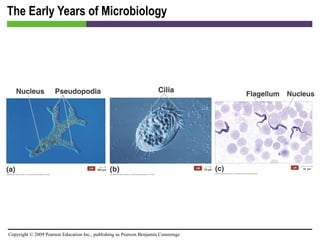 The Early Years of Microbiology 