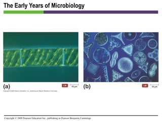 The Early Years of Microbiology 