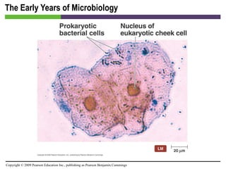 The Early Years of Microbiology 