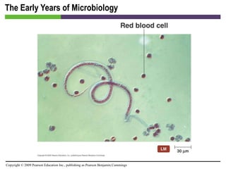 The Early Years of Microbiology 