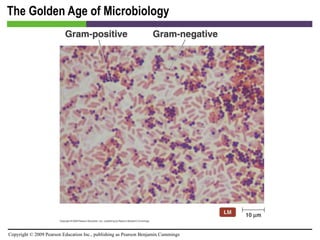 The Golden Age of Microbiology 