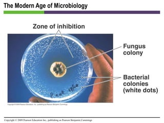 The Modern Age of Microbiology 