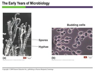 The Early Years of Microbiology 