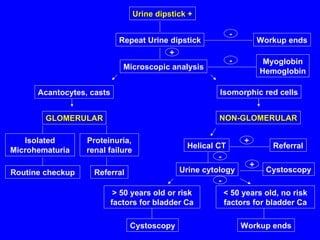 Urine dipstick + Repeat Urine dipstick Workup ends Microscopic analysis Myoglobin Hemoglobin Workup ends Cystoscopy Cystoscopy > 50 years old or risk factors for bladder Ca < 50 years old, no risk factors for bladder Ca Isomorphic red cells NON-GLOMERULAR Referral Helical CT Urine cytology - - + + - + - Acantocytes, casts GLOMERULAR Isolated Microhematuria Proteinuria, renal failure Routine checkup Referral 