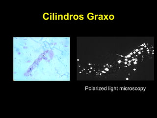 Cilindros Graxo Polarized light microscopy 