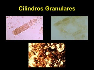 Cilindros Granulares 
