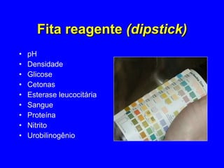 Fita reagente  (dipstick) pH Densidade Glicose Cetonas Esterase leucocitária Sangue Proteína Nitrito Urobilinogênio 