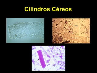 Cilindros Céreos 