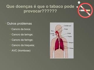 Que doenças é que o tabaco pode provocar?????? Outros problemas Cancro da boca; Cancro da laringe; Cancro da faringe; Cancro da traqueia; AVC (trombose) 