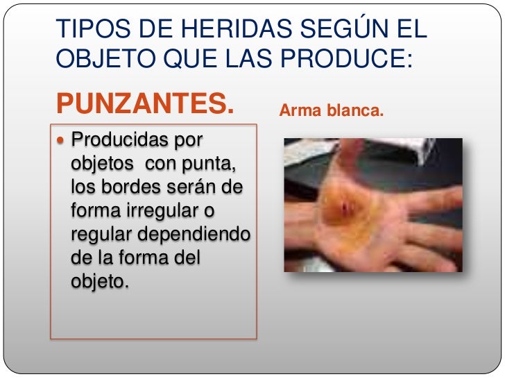 Los ejercicios y la metodología el aumento del pene