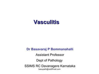 Vasculitis  Dr Basavaraj P Bommanahalli Assistant Professor Dept of Pathology  SSIMS RC Davanagere Karnataka 