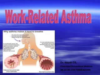 Work-Related Asthma Dr. Nayak CS,  Consultant Occupational Medicine  MB BS MD DOH FIIRSM MAOEM 