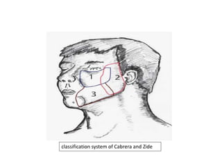 classification system of Cabrera and Zide
 