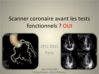 Scanner coronaire avant les tests
fonctionnels ? OUI
CFCI 2011
Paris
Alain TAVILDARI
Clinique Axium – Aix en Provence
 