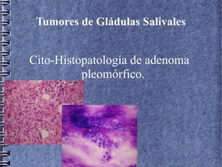 Tumores de Gládulas Salivales


Cito-Histopatología de adenoma
          pleomórfico.
 