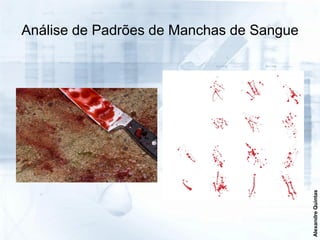 Análise de Padrões de Manchas de Sangue




                                          Alexandre Quintas
 