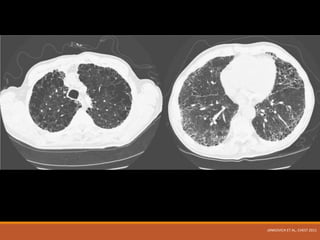 JANKOVICH ET AL, CHEST 2011
 