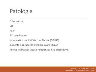 Patologia
Entre outros:
UIP
NSIP
PID com fibrose
bronquiolite respiratória com fibrose (DPI-BR)
aumento dos espaços alveolares com fibrose
fibrose intersticial tabaco-relacionada não-classificável
COTTIN ET AL. EUR RESPIR J . 2005
KAWABATA ET AL HISTOPATHOLOGY . 2008
 