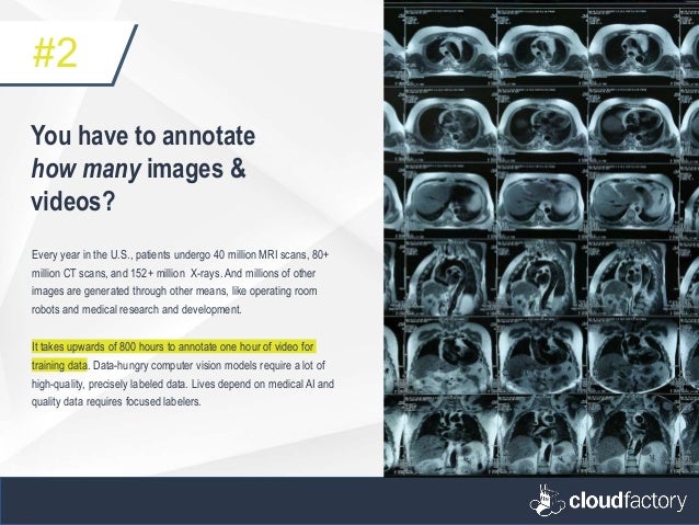 You have to annotate
how many images &
videos?
Every year in the U.S., patients undergo 40 million MRI scans, 80+
million CT scans, and 152+ million X-rays. And millions of other
images are generated through other means, like operating room
robots and medical research and development.
It takes upwards of 800 hours to annotate one hour of video for
training data. Data-hungry computer vision models require a lot of
high-quality, precisely labeled data. Lives depend on medical AI and
quality data requires focused labelers.
#2
 