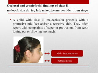 Occlusal and craniofacial findings of class II
malocclusion during late mixed/permanent dentition stage
• A child with class II malocclusion presents with a
protrusive mid-face and/or a retrusive chin. They often
report with complaints of superior protrusion, front teeth
jutting out or showing too much.
.
Mid – face protrusive
Retrusive chin
 